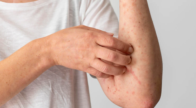 itchy skin rash telehealth